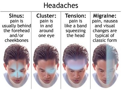 type of headache